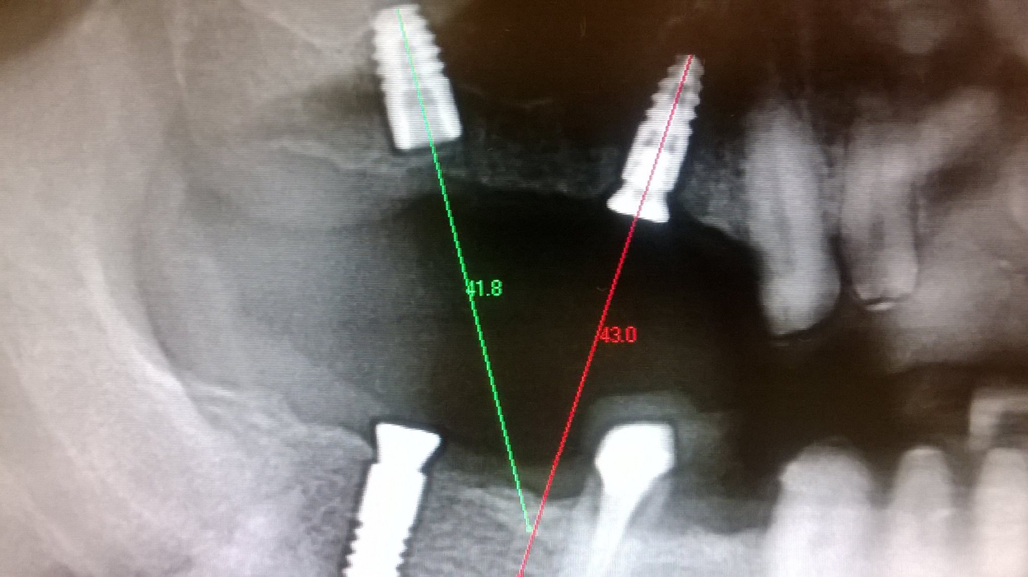image2